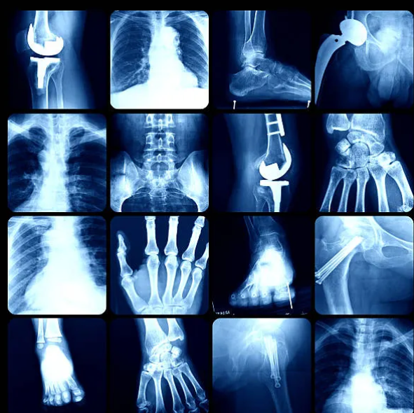 X-ray AI App Screenshot